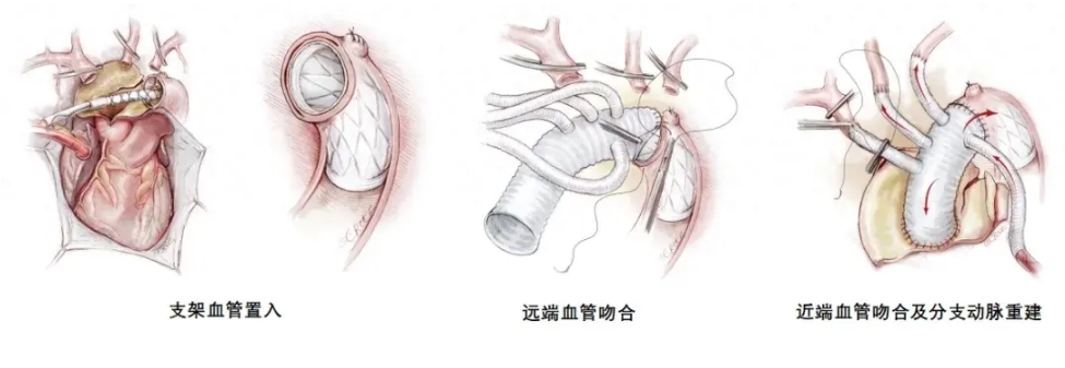 微信截图_20240419085745