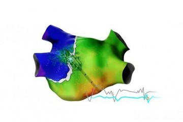 最新！强生人工智能心脏标测系统 CARTO™ 3 上市